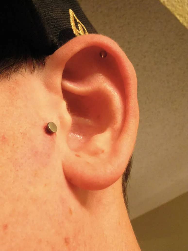 Ear Dermal Piercing