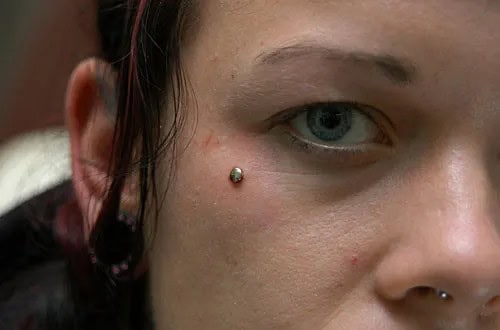 Facial Dermal Piercing